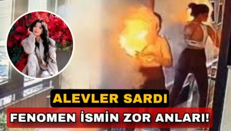 Çantadaki powerbank patladı: Genç influencer alevler içinde kaldı