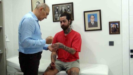 Kopan Bileği 8 Saatlik Ameliyatla Yerine Dikilen Barmen, Hekimiyle Buluştu